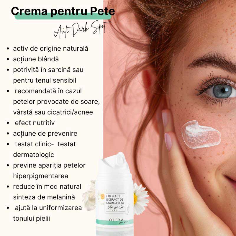 Anti Dark Spot Cream  - Crema pentru Pete Pigmentare cu Extract de Margareta