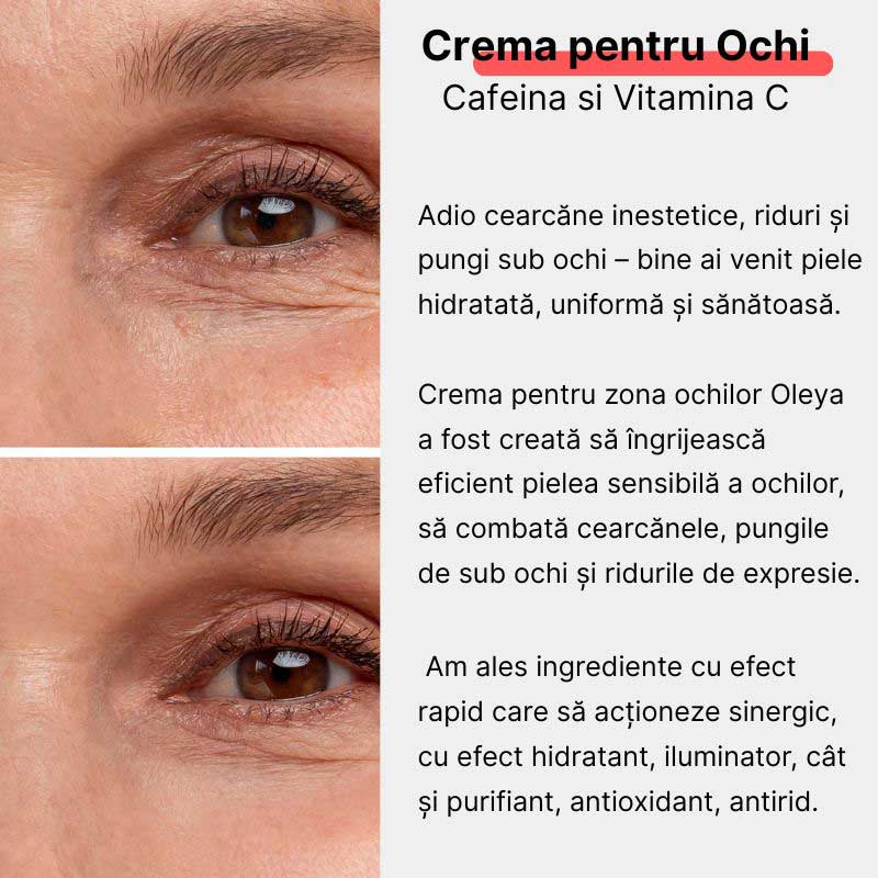 Anti-aging Radiance Eye Complex - Crema contur ochi cu Vitamina C si Cafeina 2%