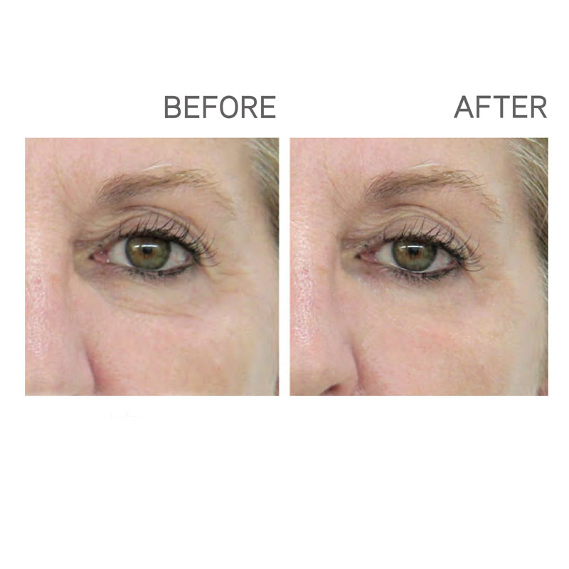 2 Min Lift Eye - Ser lifting instant cu Ovaz si Oligopeptide naturale